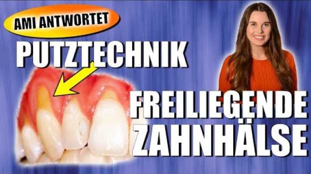 Video Freiliegende Zahnhälse und keilförmige Defekte - Putztechnik | DoctorAmi em Portuguese