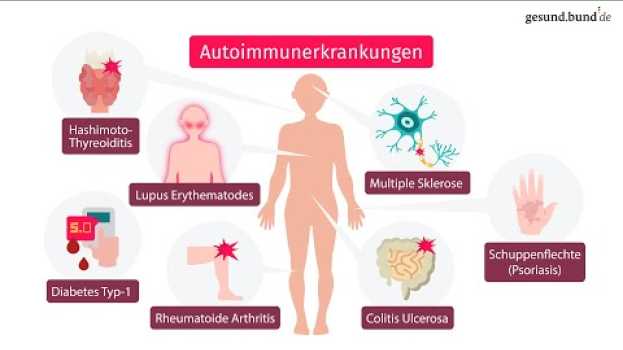 Video Was ist eine Autoimmunerkrankung? in English